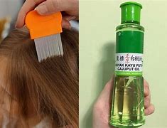 Cara Menghilangkan Kutu Rambut Dengan Minyak Kayu Putih